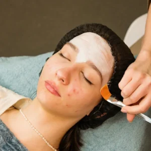 Acne Clear Treatment